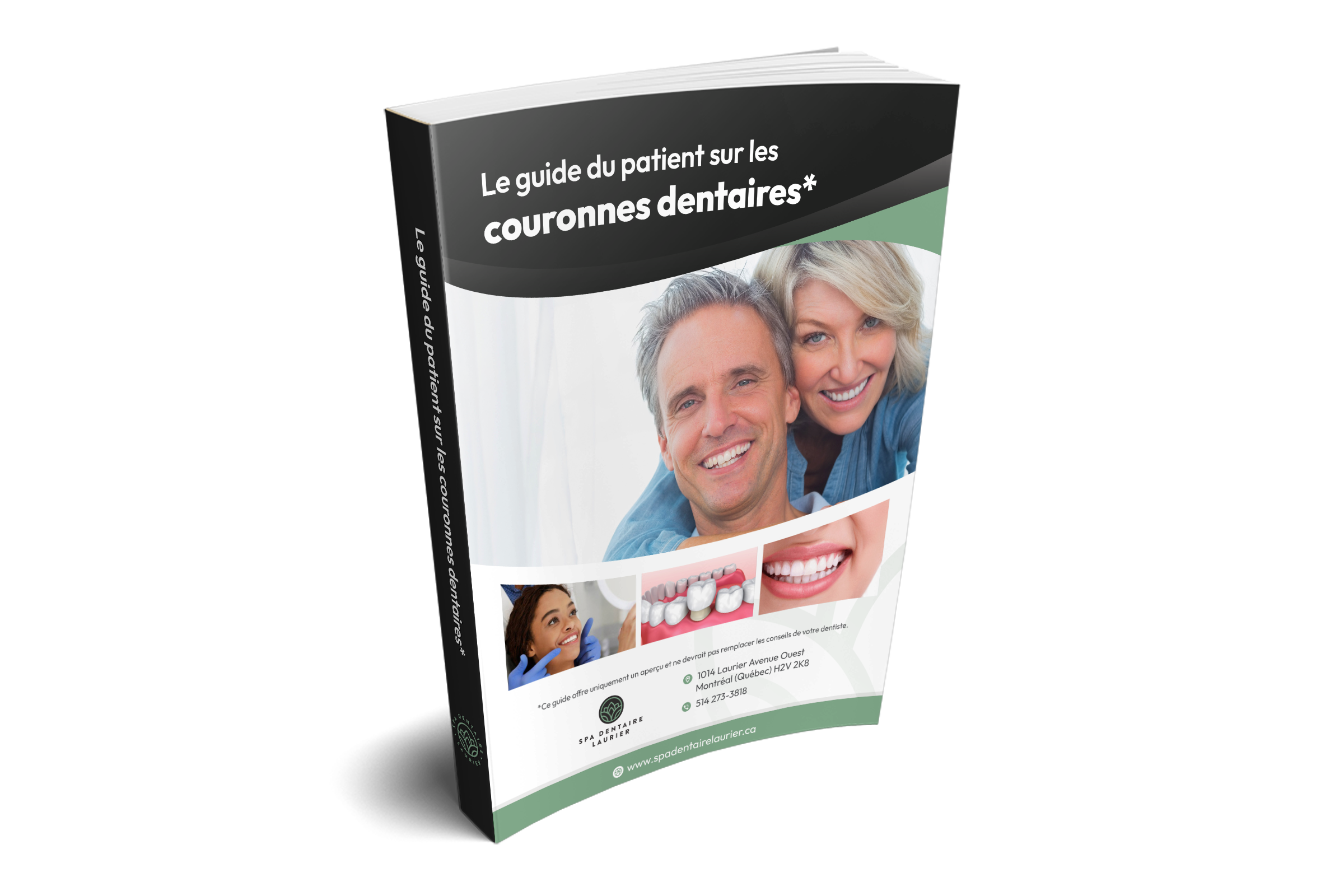 Guide de couronnes dentaires