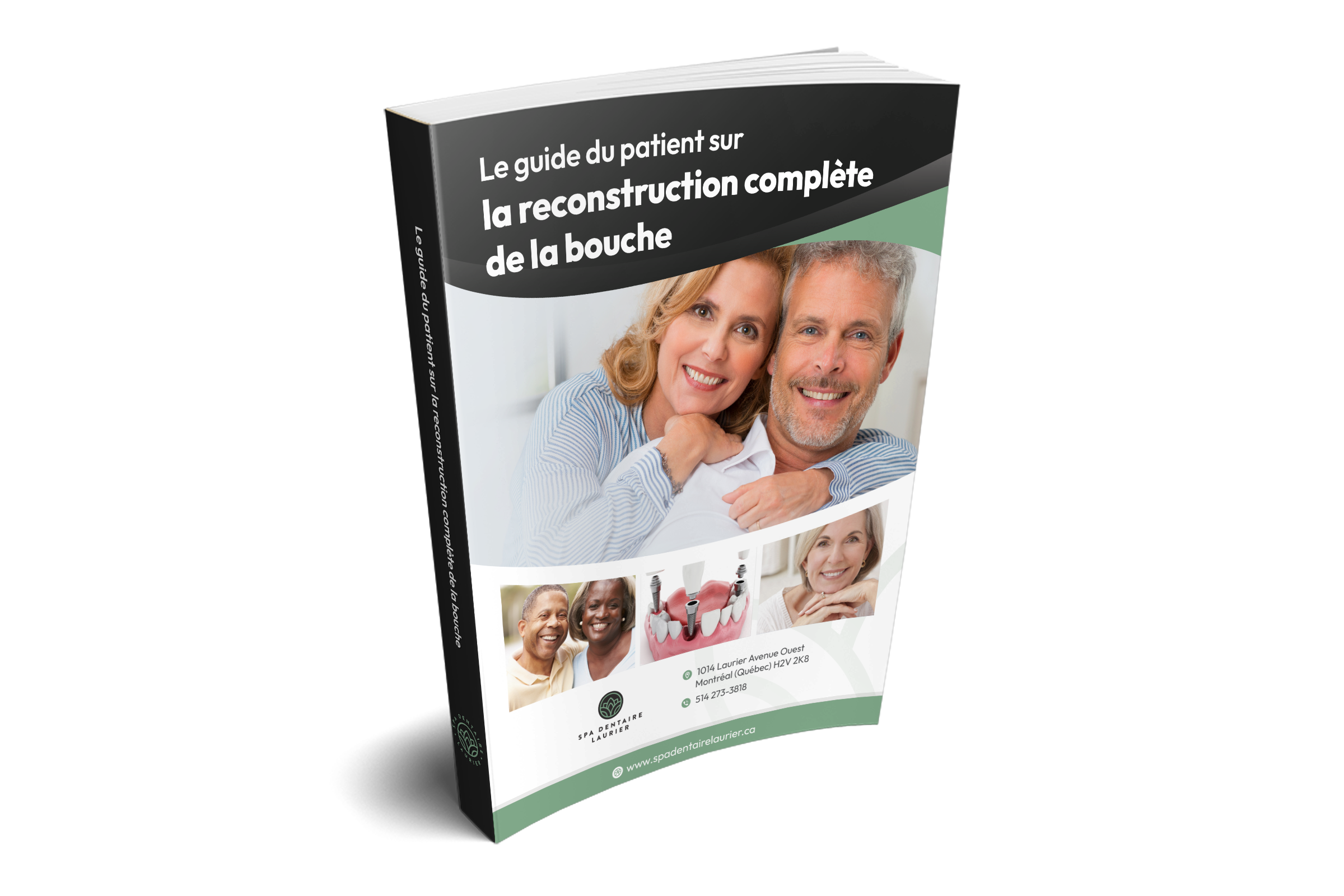 Guide de reconstruction complète de la bouche